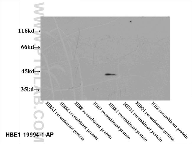 HBE1 Antibody in Western Blot (WB)