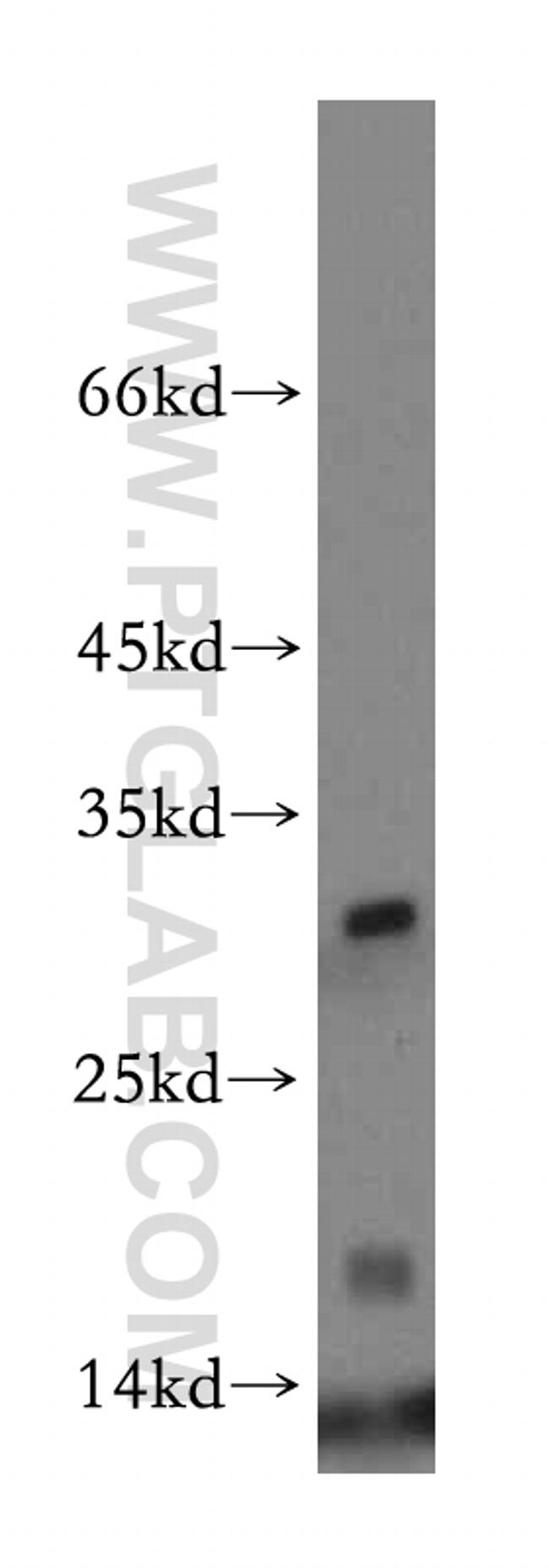 HBM Antibody in Western Blot (WB)