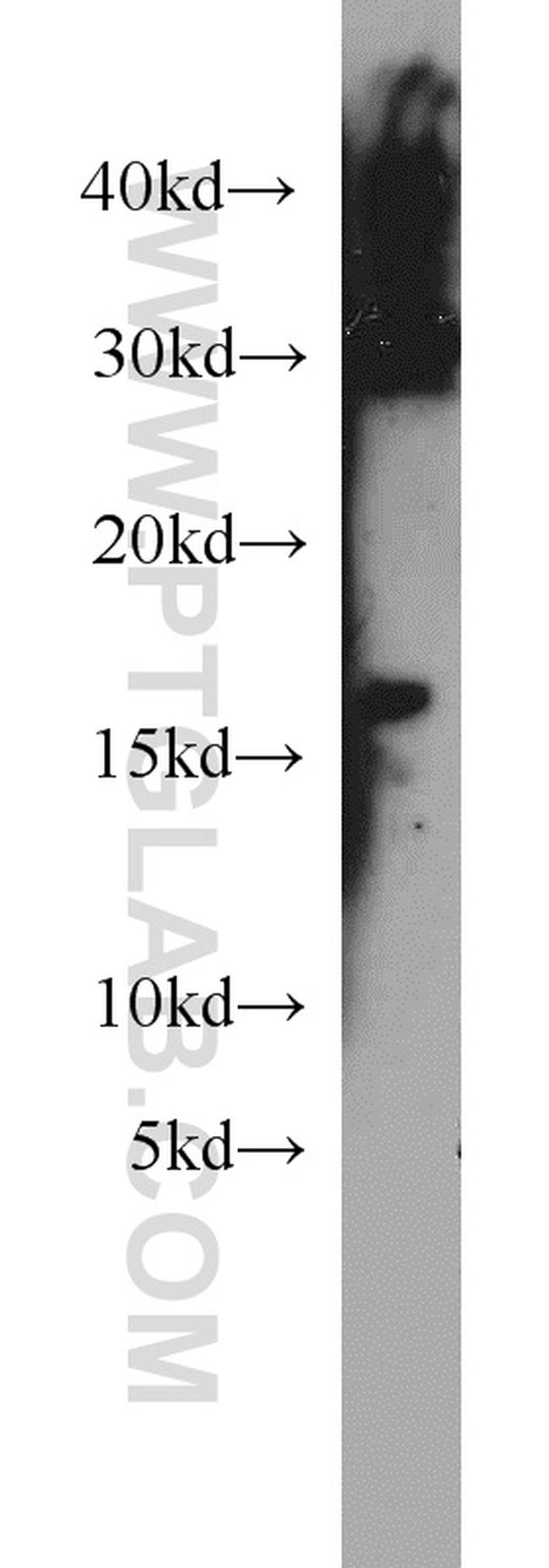 HBM Antibody in Western Blot (WB)