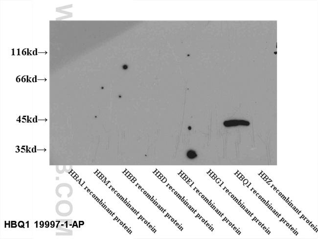 HBQ1 Antibody in Western Blot (WB)