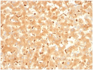 Alpha-2-Macroglobulin Antibody in Immunohistochemistry (Paraffin) (IHC (P))