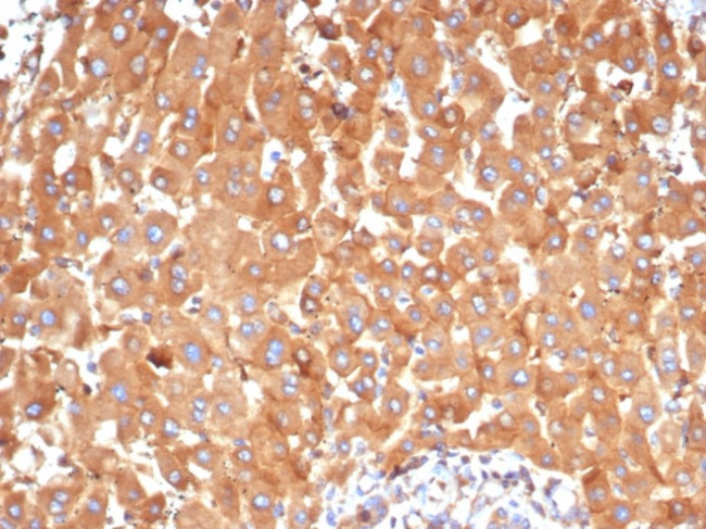 Alpha-2-Macroglobulin/A2M Antibody in Immunohistochemistry (Paraffin) (IHC (P))