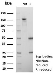 Alpha-2-Macroglobulin/A2M Antibody in SDS-PAGE (SDS-PAGE)