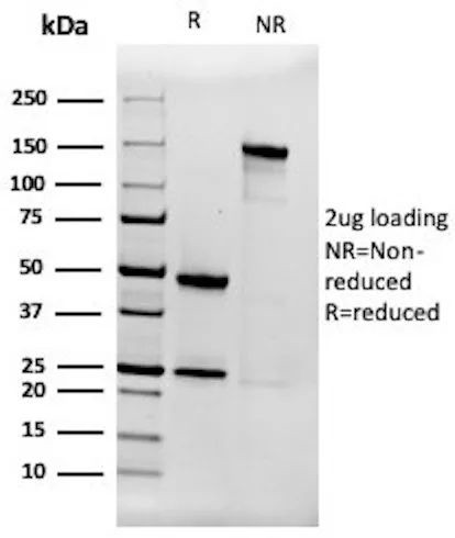 Alpha-2-Macroglobulin Antibody in SDS-PAGE (SDS-PAGE)