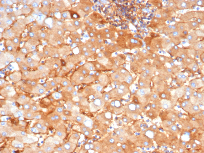 Alpha-2-Macroglobulin Antibody in Immunohistochemistry (Paraffin) (IHC (P))