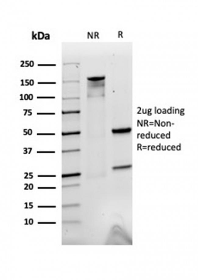 Alpha-2-Macroglobulin Antibody in SDS-PAGE (SDS-PAGE)