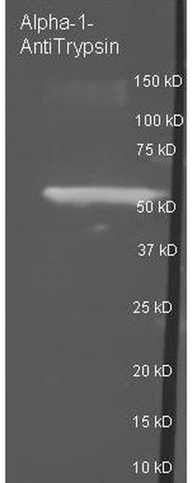 alpha-1-Anti-Trypsin Antibody in Western Blot (WB)