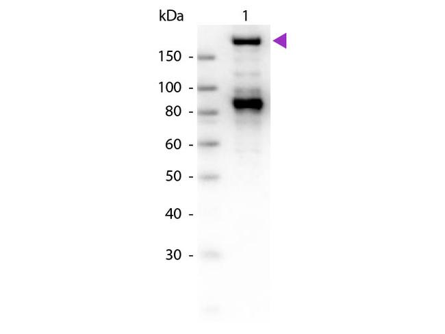 alpha-2-Macroglobulin Antibody in Western Blot (WB)