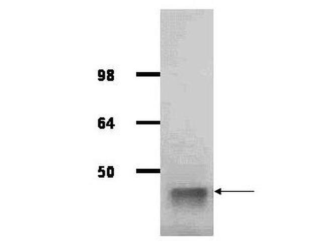 Aldolase Antibody in Western Blot (WB)