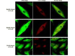 Fructose-6-Phosphate Kinase Antibody in Immunocytochemistry (ICC/IF)