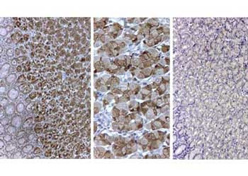 Pepsin Antibody in Immunohistochemistry (IHC)