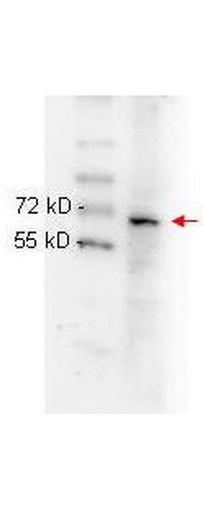 NFkB p65 Antibody in Western Blot (WB)