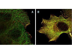 Phospho-AKT (Ser473) Antibody in Immunocytochemistry (ICC/IF)