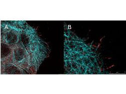 Phospho-AKT (Ser473) Antibody in Immunocytochemistry (ICC/IF)