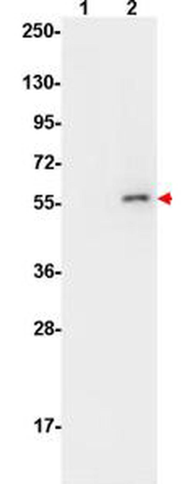 Phospho-AKT (Ser473) Antibody in Western Blot (WB)
