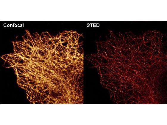 alpha-Tubulin Antibody in Immunocytochemistry (ICC/IF)