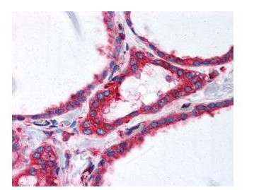 alpha-Tubulin Antibody in Immunohistochemistry (Paraffin) (IHC (P))