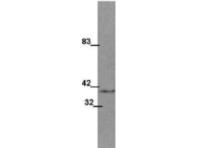 Wnt1 Antibody in Western Blot (WB)