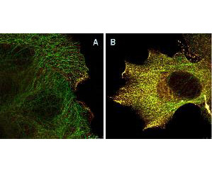 Phospho-AKT (Ser473) Antibody in Immunocytochemistry (ICC/IF)