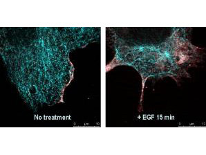 Phospho-AKT (Ser473) Antibody in Immunocytochemistry (ICC/IF)