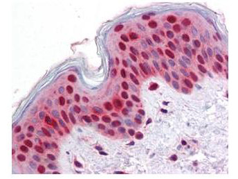 Stat2 Antibody in Immunohistochemistry (Paraffin) (IHC (P))