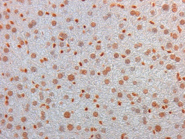 AKT3 Antibody in Immunohistochemistry (Paraffin) (IHC (P))