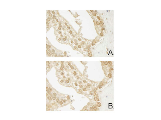 AKT3 Antibody in Immunohistochemistry (Paraffin) (IHC (P))