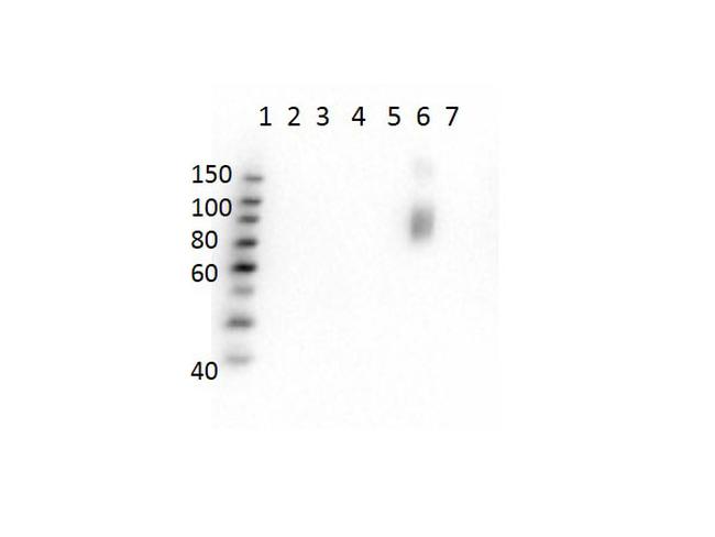 Hemoglobin beta S Antibody in Western Blot (WB)