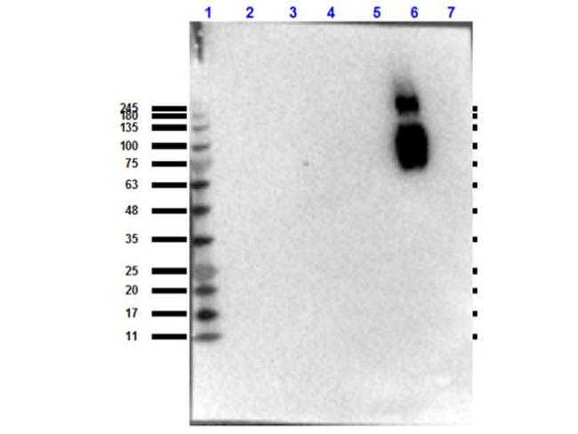 Hemoglobin beta S Antibody in Western Blot (WB)