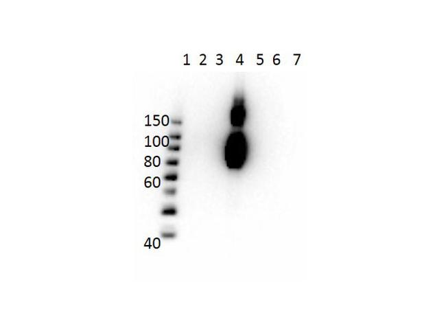 Hemoglobin beta C Antibody in Western Blot (WB)