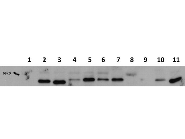 AKT1 Antibody in Western Blot (WB)