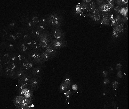 AKT3 Antibody in Immunocytochemistry (ICC/IF)