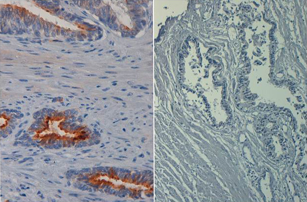 Phospho-AKT (Ser473) Antibody in Immunohistochemistry (Paraffin) (IHC (P))