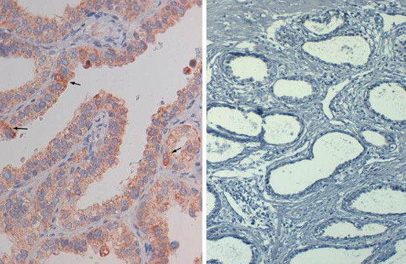 Phospho-AKT (Ser473) Antibody in Immunohistochemistry (Paraffin) (IHC (P))