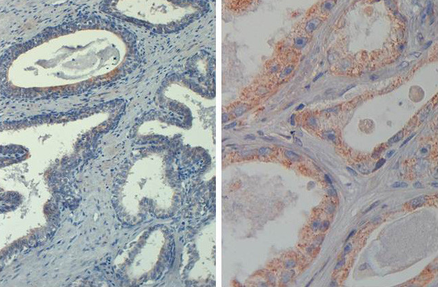 Phospho-AKT (Thr308) Antibody in Immunohistochemistry (Paraffin) (IHC (P))