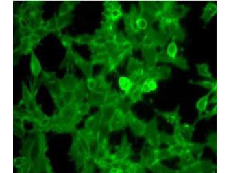 beta-2-Microglobulin Antibody in Immunocytochemistry (ICC/IF)