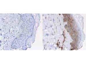 beta-2-Microglobulin Antibody in Immunohistochemistry (Paraffin) (IHC (P))