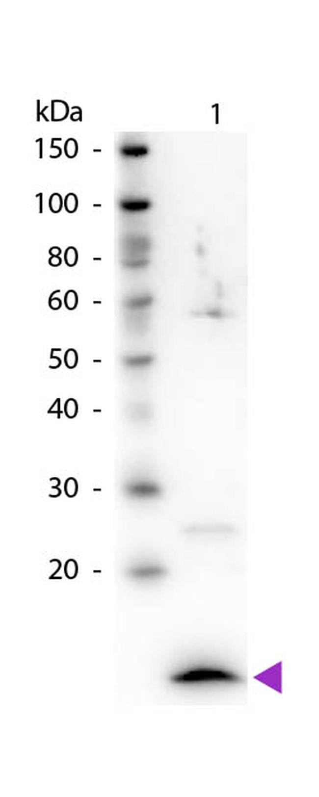 beta-2-Microglobulin Antibody in Western Blot (WB)