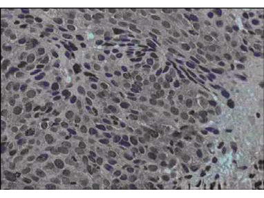 Jagged 1 Antibody in Immunohistochemistry (Paraffin) (IHC (P))