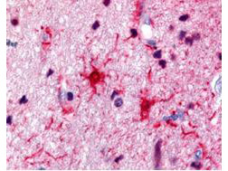 S100 Protein Antibody in Immunohistochemistry (Paraffin) (IHC (P))