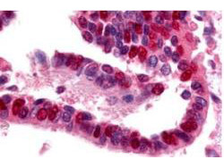 Ubiquitin Activating Enzyme E1 Antibody in Immunohistochemistry (Paraffin) (IHC (P))