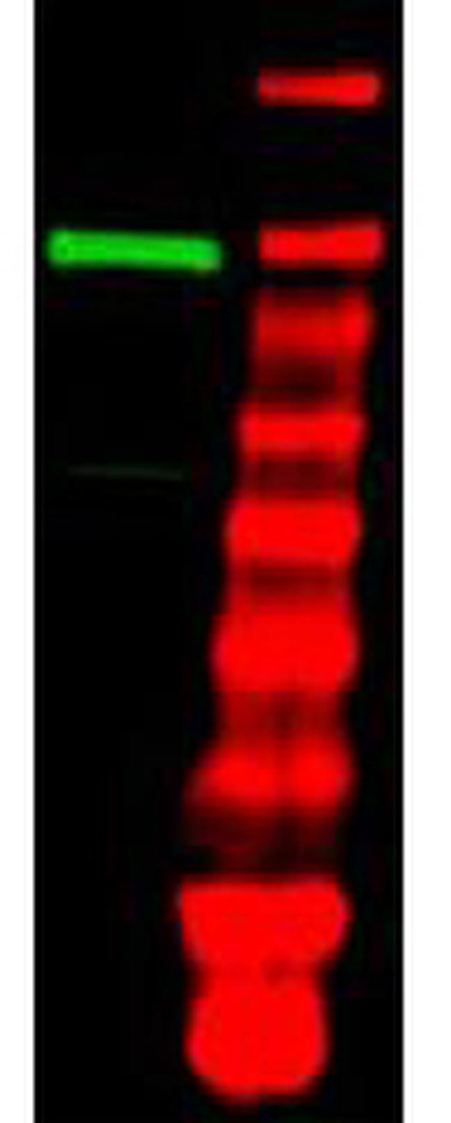 Ubiquitin Activating Enzyme E1 Antibody in Western Blot (WB)