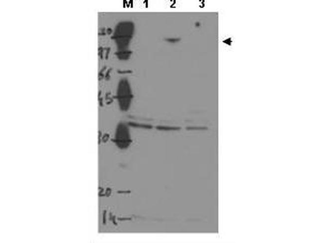 ASPP2 Antibody in Western Blot (WB)