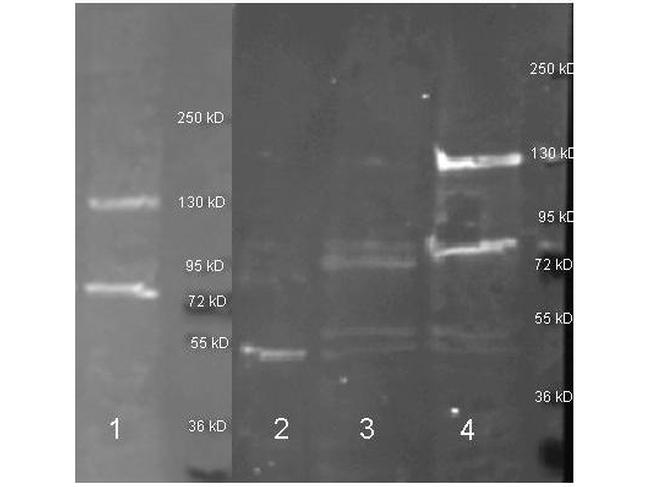 Adenosine Deaminase Antibody in Western Blot (WB)