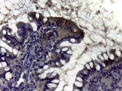 Carbonic Anhydrase II Antibody in Immunohistochemistry (IHC)