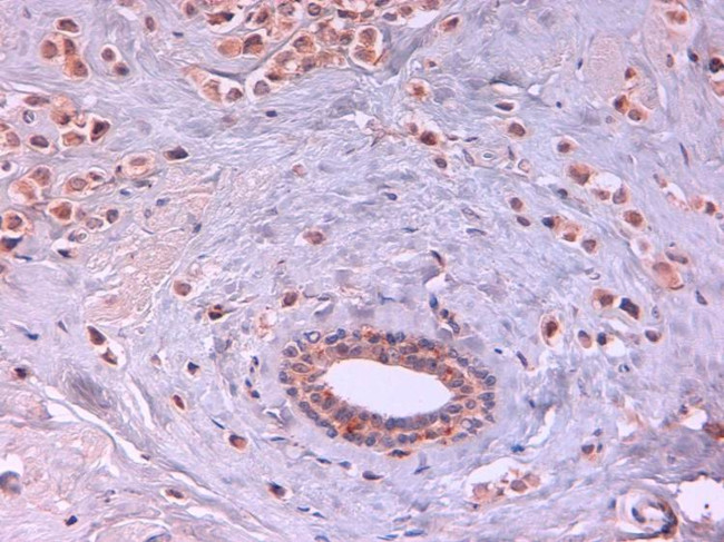 AKT2 Antibody in Immunohistochemistry (Paraffin) (IHC (P))