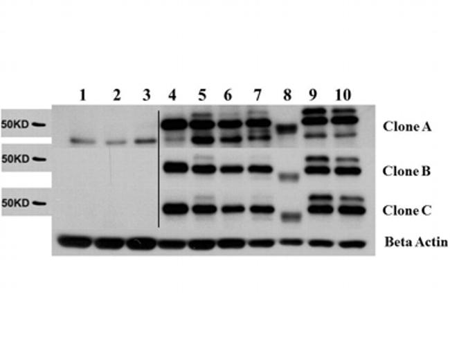 AKT2 Antibody in Western Blot (WB)