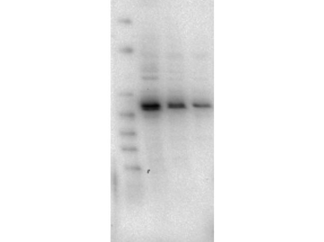 AKT2 Antibody in Western Blot (WB)