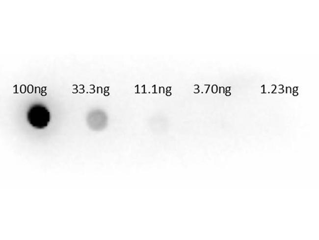 Aspartate Transaminase Antibody in Dot Blot (DB)