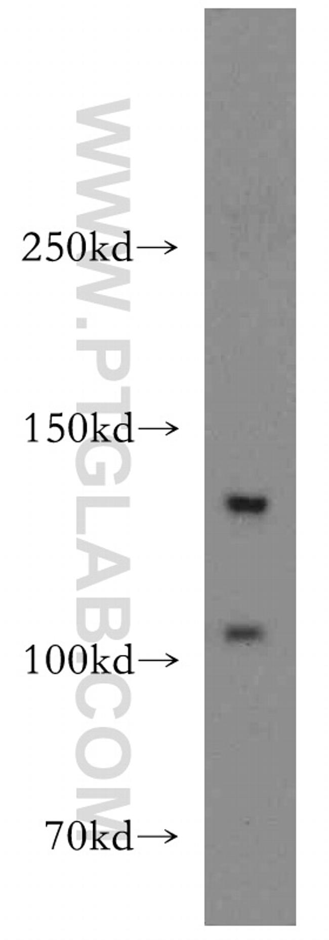 TGFBR3 Antibody in Western Blot (WB)